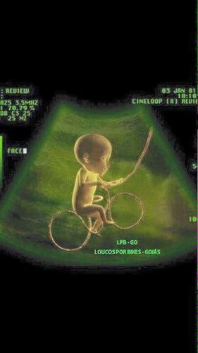 ba3163ebc584d621dbc65e66bf2cfb5d